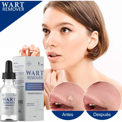 ¡COMPRE 1 Y LLÉVESE 2 GRATIS! - WART REMOVER - REMOVEDOR DE VERRUGA